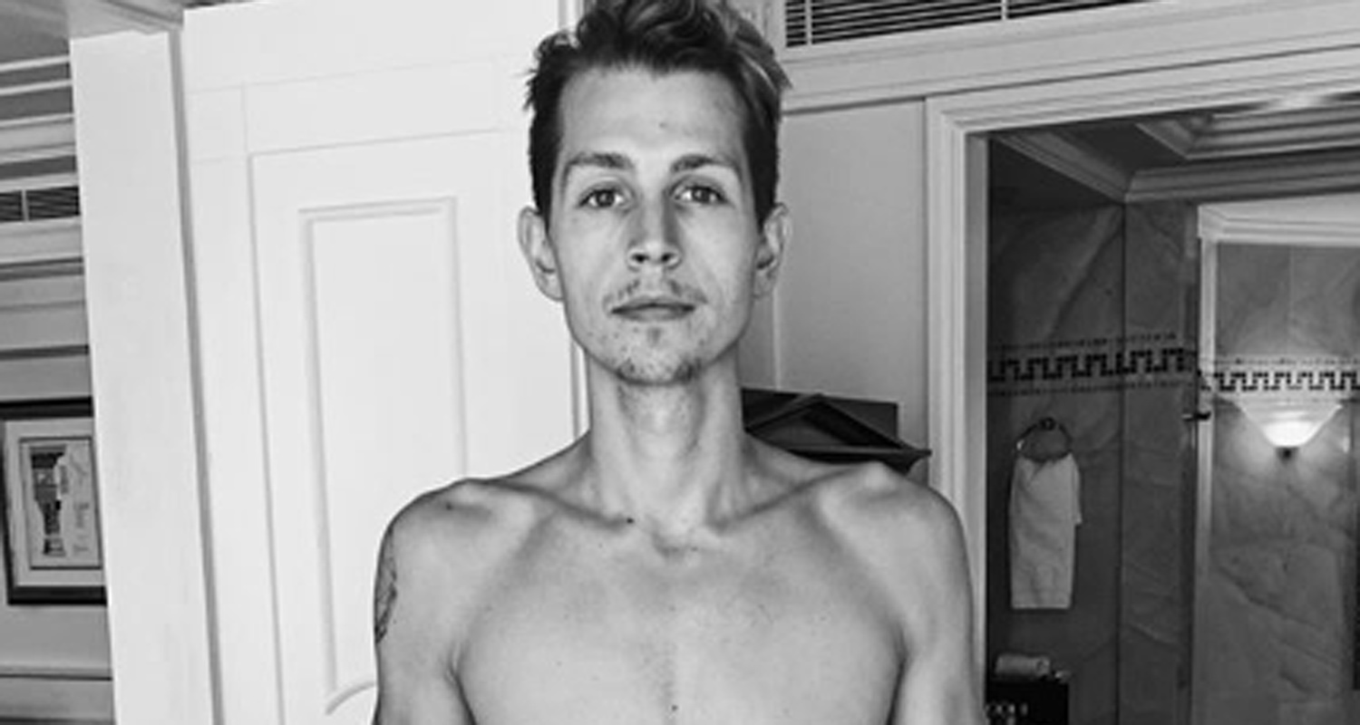 The Vamps James Mcvey Goes Shirtless To Show Off His Dramatic