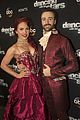sharna burgess exclusive dwts blog knee injury more 03