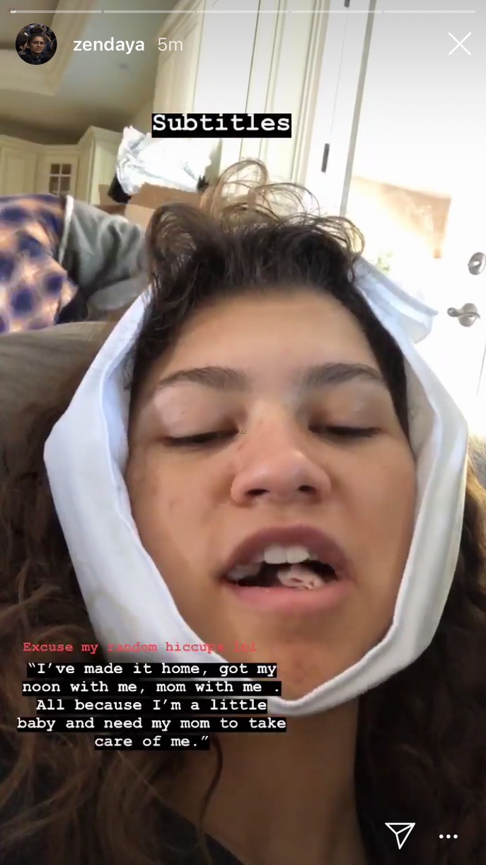 Funny wisdom teeth discount videos