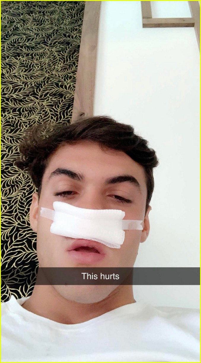 Dolan Twins Ethan & Grayson Undergo Sinus Surgery | Photo 1251920 ...