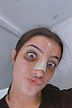 charli damelio shares new photos post nose surgery 01