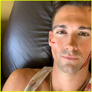 James Maslow Gets 'Bloodied' Up While Filming 'Wolf Hound'