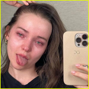 Dove Cameron Shares Teary Post About Struggling with Depression